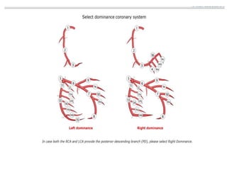 Revascularizacioncoronariaendiabetesamn2017