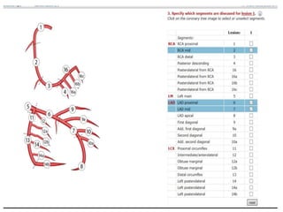 Revascularizacioncoronariaendiabetesamn2017