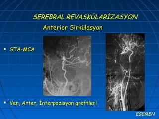 SEREBRAL REVASKÜLARİZASYON
                 Anterior Sirkülasyon


   STA-MCA




   Ven, Arter, İnterpozisyon greftleri

                                          EGEMEN
 