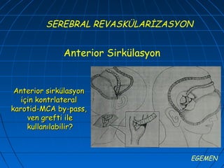 SEREBRAL REVASKÜLARİZASYON


              Anterior Sirkülasyon


 Anterior sirkülasyon
   için kontrlateral
karotid-MCA by-pass,
     ven grefti ile
     kullanılabilir?



                                     EGEMEN
 