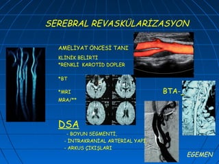 SEREBRAL REVASKÜLARİZASYON

  AMELİYAT ÖNCESİ TANI
  KLİNİK BELİRTİ
  *RENKLİ KAROTİD DOPLER

  *BT

  *MRI                             BTA-
  MRA/**




  DSA
    - BOYUN SEGMENTİ,
   - İNTRAKRANİAL ARTERİAL YAPI,
   - ARKUS ÇIKIŞLARI
                                          EGEMEN
 