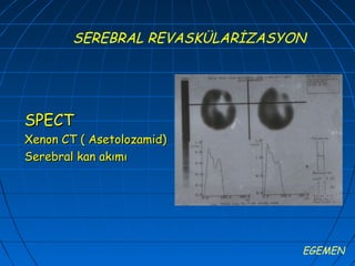 SEREBRAL REVASKÜLARİZASYON




SPECT
Xenon CT ( Asetolozamid)
Serebral kan akımı




                                 EGEMEN
 
