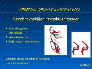 SEREBRAL REVASKÜLARİZASYON

       Serebrovasküler revaskülerizasyon

   ICA oklüzyonlu
    hastalarda
   Anevrizmalarda
   Kafa tabanı tümörlerinde




Serebral iskemi ve inmeden korunmak
için kullanılmaktadır
                                       EGEMEN
 
