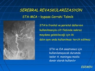 SEREBRAL REVASKÜLARİZASYON
 STA-MCA – bypass Cerrahi Teknik

           STA’in frontal ve parietal dallarının
           kullanılmasıyla cilt flebinde nekroz
           meydana gelebileceği için iki
           dalın aynı anda kullanılması tercih edilmez


                   STA ve OA anastomoz için
                   kullanılamayacak durumda
                   iseler A. meningea media
                   donör olarak kullanılır

                                              EGEMEN
 