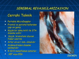 SEREBRAL REVASKÜLARİZASYON

    Cerrahi Teknik
   Portable MicroDoppler
   Frontal ve parietal kollardan
    çapı en geniş
   Küçük bir doku kılıfı ile STA
    disseke edilir
    Küçük kraniotomi slyvian
    fissür üzerine
   Arter en az 1 mm. olmalıdır
   Araknoid’inden disseke
    edilmelidir
   9-10/0 monoflaman sütürler
    SEP veya EEG
                                     EGEMEN
 