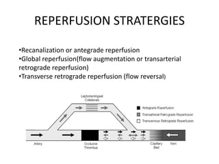 revasularisation of acute stroke.pptx