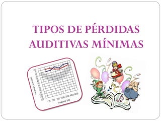 TIPOS DE PÉRDIDAS
AUDITIVAS MÍNIMAS
 