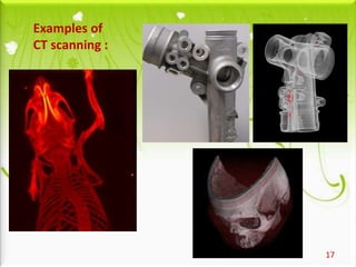 17
Examples of
CT scanning :
 