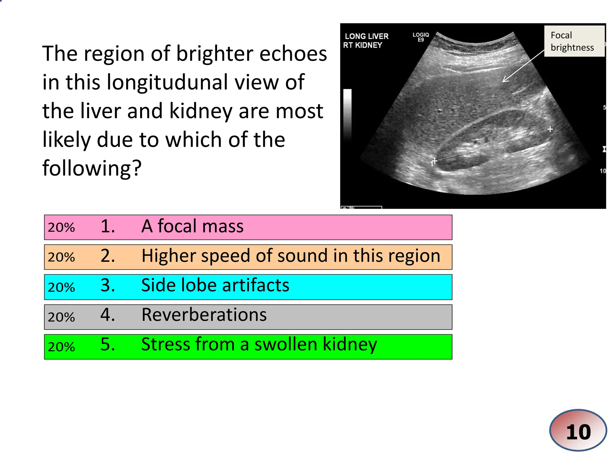 Tomb Reverberation Reverberation Artifacts in ultrasound imaging | PDF