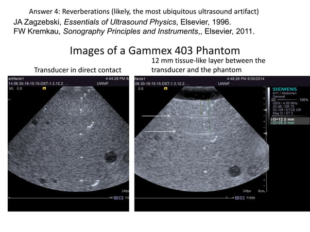 Reverberation Artifacts in ultrasound imaging | PDF
