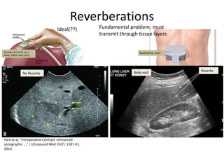 Emporal Reverberation Reverberation Artifacts in ultrasound imaging | PDF