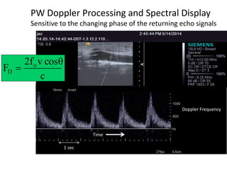 Emporal Reverberation Reverberation Artifacts in ultrasound imaging | PDF