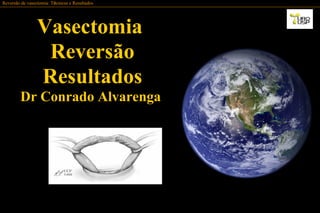 Reversão de vasectomia: TReversão de vasectomia: Téécnicas e Resultadoscnicas e Resultados
VasectomiaVasectomia
ReversãoReversão
ResultadosResultados
Dr Conrado AlvarengaDr Conrado Alvarenga
 