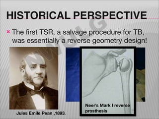 HISTORICAL PERSPECTIVE
!

G
L
U

The first TSR, a salvage procedure for TB,
was essentially a reverse geometry design!

W
...