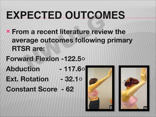 EXPECTED OUTCOMES

G
L
U

From a recent literature review the
average outcomes following primary
RTSR are:
Forward Flexion...