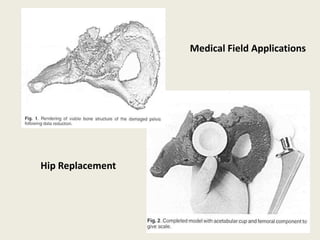 Medical Field Applications




Hip Replacement
 
