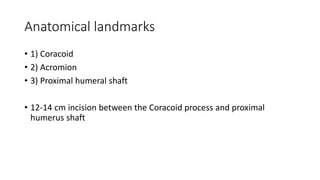 Anatomical landmarks
• 1) Coracoid
• 2) Acromion
• 3) Proximal humeral shaft
• 12-14 cm incision between the Coracoid process and proximal
humerus shaft
 