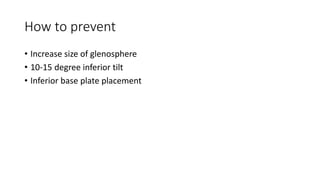How to prevent
• Increase size of glenosphere
• 10-15 degree inferior tilt
• Inferior base plate placement
 