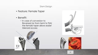 Stem Reverse Shoulder reverse Shoulder presentation.pdf