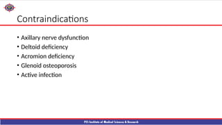 Shouder Rfa reverse shouder arthroplasty technique ppt | PPTX