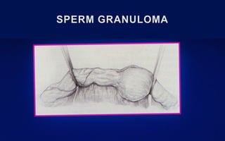 IDADE DA PARCEIRAGERRARD ET AL, FERTIL STERIL, 2007.