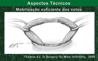 REVERSÃO DE VASECTOMIAPreditores de sucesso no intra-operatório