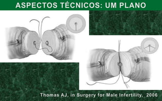 Comprimento do coto do deferente testicular