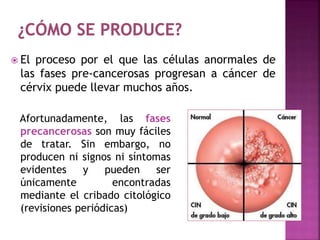  El proceso por el que las células anormales de
las fases pre-cancerosas progresan a cáncer de
cérvix puede llevar muchos años.
Afortunadamente, las fases
precancerosas son muy fáciles
de tratar. Sin embargo, no
producen ni signos ni síntomas
evidentes y pueden ser
únicamente encontradas
mediante el cribado citológico
(revisiones periódicas)
 