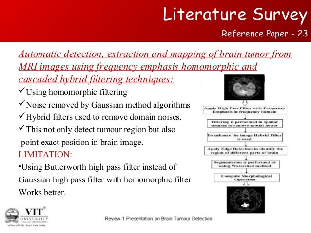 Types of brain tumors picture