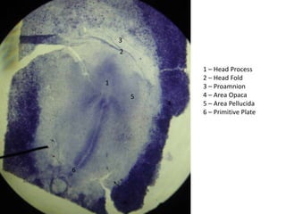 3
        2

                    1 – Head Process
                    2 – Head Fold
    1               3 – Proamnion
            5       4 – Area Opaca
                4   5 – Area Pellucida
                    6 – Primitive Plate




6
 