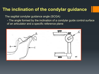 Review Occlusion -Refresher.pdf