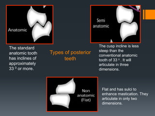 Teeth Incliners Review Occlusion -Refresher.pdf