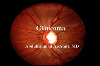 Glaucoma
Abdulrahman Al-Amri, MD
 