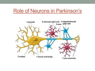 Role of Neurons in Parkinson’s 
 