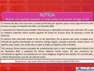 NOTÍCIA
    Menino com agulhas alojadas no corpo passa por terceira cirurgia na BA
O menino de dois anos que teve o corpo perfurado por agulhas passa nesta segunda-feira pela
terceira cirurgia no Hospital Ana Néri, em Salvador (BA).
A assessoria de imprensa da unidade informou que a operação começou por volta das 17h e que
os médicos esperam retirar quatro agulhas do corpo da criança: duas do pescoço e duas da
clavícula.
O menino está internado desde o dia 13 de dezembro. Ele já passou por duas cirurgias para
retirada de agulhas localizadas no intestino, bexiga, fígado, coração e pulmão. Ainda restam 13
agulhas pelo corpo, mas ainda não se sabe se todos os objetos serão retirados.
Três pessoas foram presas acusadas de envolvimento com o caso, investigado pela Polícia Civil
de Ibotirama (BA): o padrasto da vítima, Roberto Carlos Lopes, 30, que confessou ter
introduzido as agulhas no enteado em um ritual religioso, Angelina dos Santos, 47, amante dele,
e Maria Nascimento, que diz ser mãe de santo.
              Disponível em: http://www1.folha.uol.com.br/folha/cotidiano/ult95u672084.shtml
 