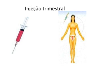 Injeção trimestral  
