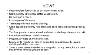 HOW?
• First complete formalities as per Government rules.
• Room is dimly lit to allow better visualization.
• Lie down on a couch.
• Expose part of abdomen.
• Tissue paper is tuck around clothing.
• Gel is applied on tummy (the gel makes good contact between probe &
skin.
• The Sonographer moves a handheld device called a probe over your skin.
• Probe is moved over skin of abdomen.
• Image may visible on monitor screen.
• May take 30 minutes or longer, depending on position of Fetus and
visibility of all the structures.
• Spine is seen better when Fetus is lying with tummy down, Face is seen
better when Fetus is lying on its back
12
 