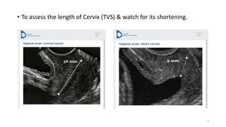 • To assess the length of Cervix (TVS) & watch for its shortening.
9
 