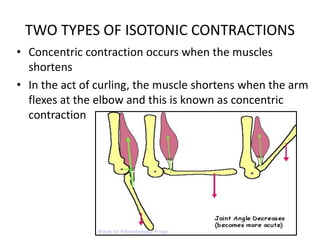 TWO TYPES OF ISOTONIC CONTRACTIONS
• Concentric contraction occurs when the muscles
shortens
• In the act of curling, the muscle shortens when the arm
flexes at the elbow and this is known as concentric
contraction
 