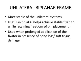 Principles of external fixation | PDF