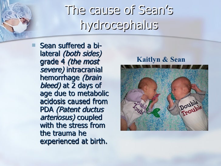 Hydrocephalus and Shunts: Sean's Story