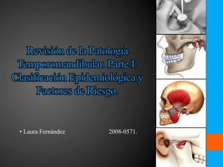 Revisión de la Patología
 Temporomandibular. Parte I:
Clasificación Epidemiológica y
      Factores de Riesgo.


 • Laura Fernández    2008-0571.
 