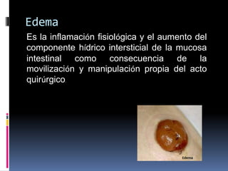 Edema
Es la inflamación fisiológica y el aumento del
componente hídrico intersticial de la mucosa
intestinal como consecuencia de la
movilización y manipulación propia del acto
quirúrgico.
 