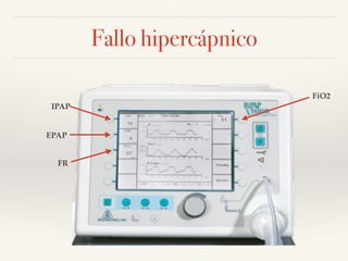 Fallo hipercápnico
IPAP
EPAP
FR
FiO2
 