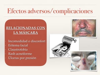 Efectos adversos/complicaciones
RELACIONADAS CON
LA MÁSCARA
- Incomodidad o disconfort
- Eritema facial
- Claustrofobia
- Rash acneiforme
- Úlceras por presión
 