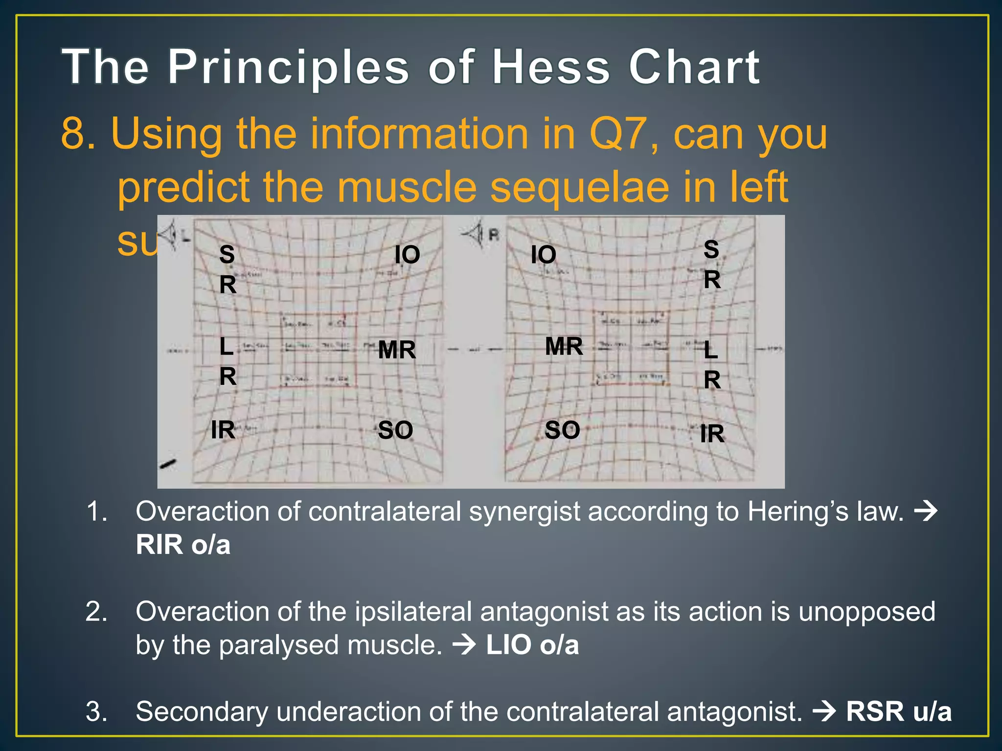 8. Using the information in Q7, can you
predict the muscle sequelae in left
superior oblique?
1. Overaction of contralateral synergist according to Hering’s law. 
RIR o/a
2. Overaction of the ipsilateral antagonist as its action is unopposed
by the paralysed muscle.  LIO o/a
3. Secondary underaction of the contralateral antagonist.  RSR u/a
S
R
L
R
IR
IO
MR
SO
IO S
R
MR
SO IR
L
R
 