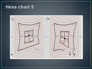 Revision about Hess Chart | PPTX