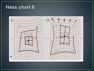 Revision about Hess Chart | PPTX