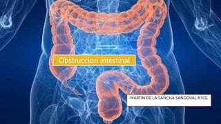 Obstruccion intestinal
MARTIN DE LA SANCHA SANDOVAL R1CG
 