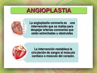 AANNGGIIOOPPLLAASSTTIIAA 
 